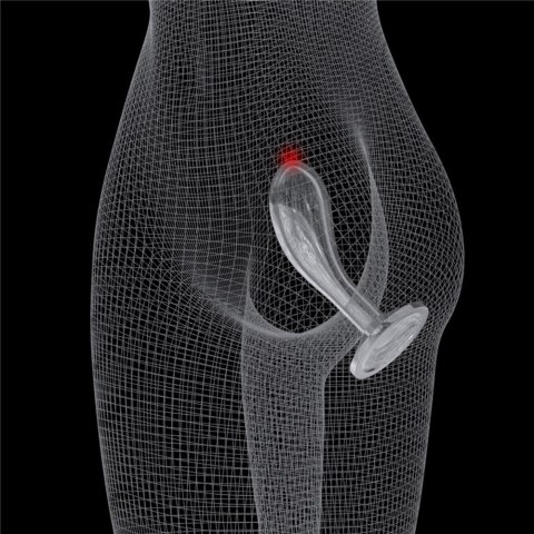 KOREK ANALNY FLAWLESS CLEAR PROSTATE PLUG 6.0'' 24-0133 KOREK ANALNY FLAWLESS CLEAR PROSTATE PLUG 6.0'' 24-0133